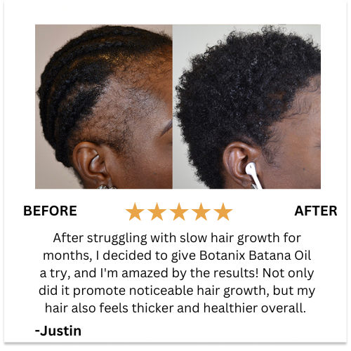Batana Natural Hair Growth Oils