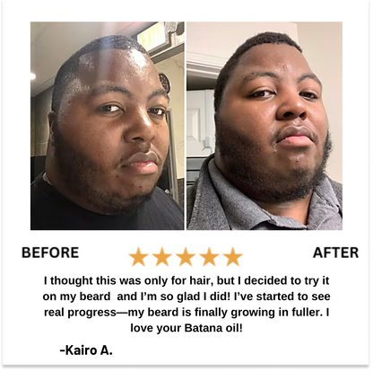 Men's Natural Batana Hair & Beard Growth Oil